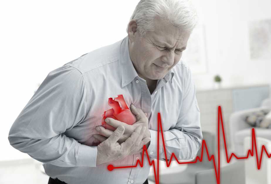 SUDDEN CARDIAC ARREST