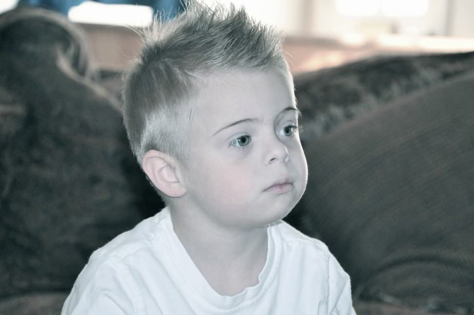 DOWN SYNDROME